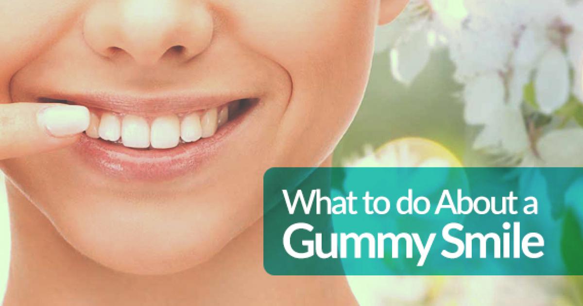 What to Do About a "Gummy" Smile